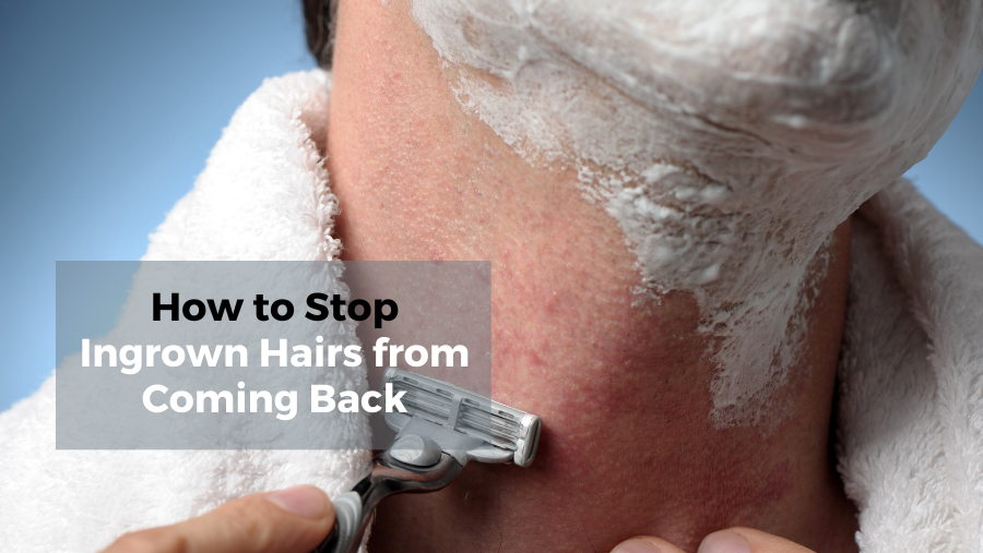 How To Stop Ingrown Hairs From Coming Back